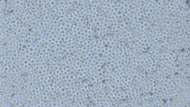 Utilizing K562 Cells for Hematological Research