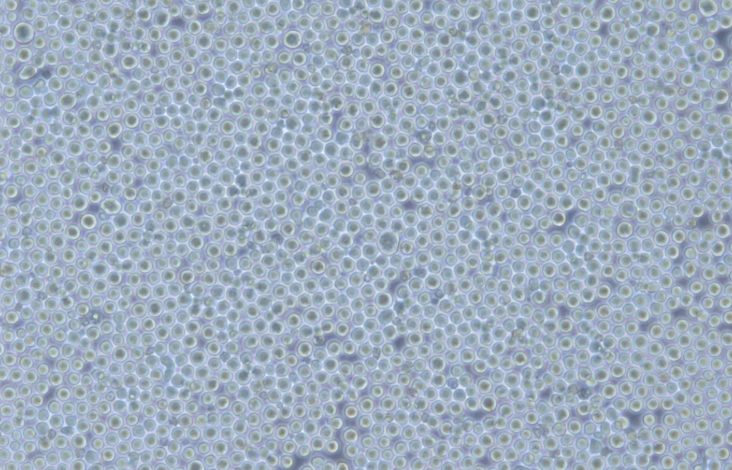 Utilizing K562 Cells for Hematological Research